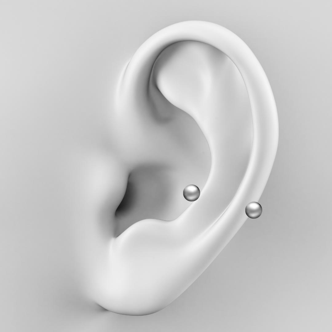 unnamed image