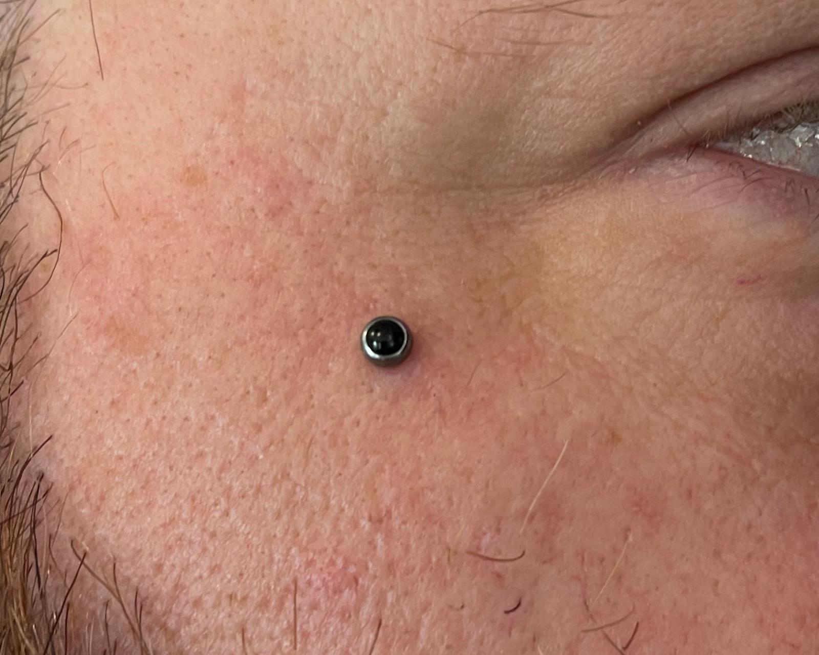 unnamed image